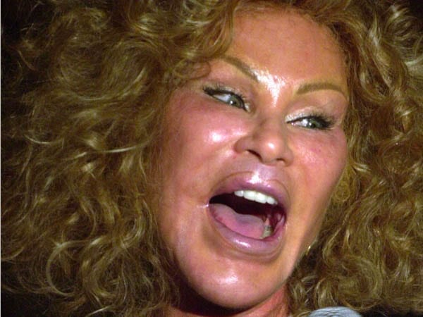 A Catty Catastrophe – Feline-like Bride of Wildenstein Jocelyn Wildenstein and couturier Lloyd Klein – Fight at Trump World Tower, Wednesday 7th December 2016 - Delony assault charges in the second degree – She is accused of inflicting injuries with a weapon