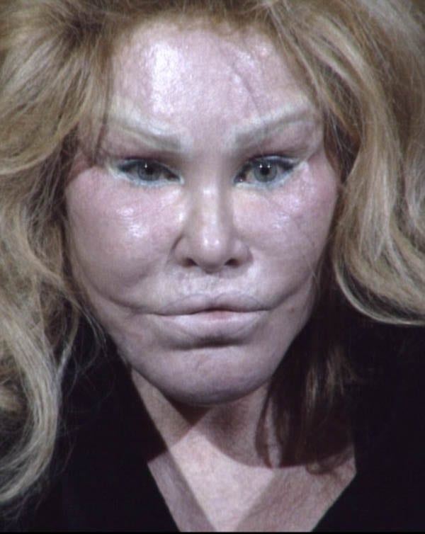 A Catty Catastrophe – Feline-like Bride of Wildenstein Jocelyn Wildenstein and couturier Lloyd Klein – Fight at Trump World Tower, Wednesday 7th December 2016 - Delony assault charges in the second degree – She is accused of inflicting injuries with a weapon