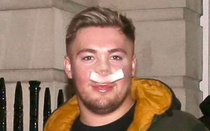 Wally of the Week – Nathan Thursfield – Healthcare worker who wants “the Katie price look” Nathan Thursfield is proven to be nothing but an utter nutter.
